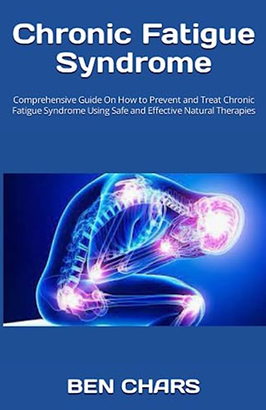 Chronic Fatigue Syndrome: Comprehensive Guide On How to Prevent and Treat Chronic Fatigue Syndrome Using Safe and Effective Natural Therapies
