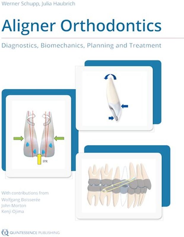 Aligner Orthodontics