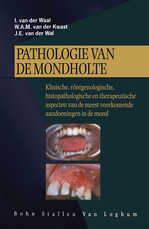 Pathologie van de mondholte