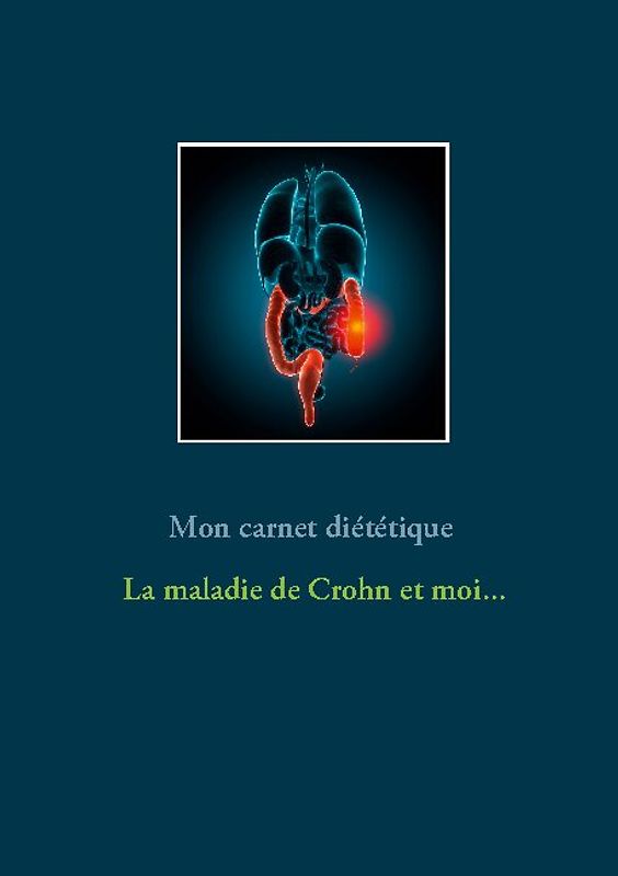 Mon carnet diététique : la maladie de Crohn et moi...