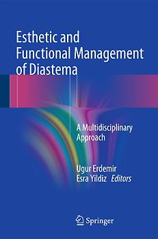 Esthetic and Functional Management of Diastema