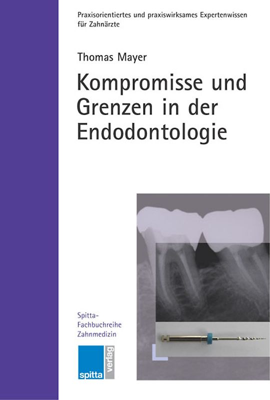 Kompromisse und Grenzen in der Endodontologie