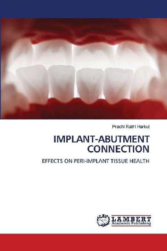 IMPLANT-ABUTMENT CONNECTION
