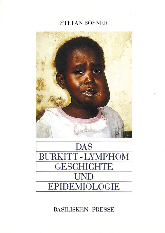 Das Burkitt-Lymphom