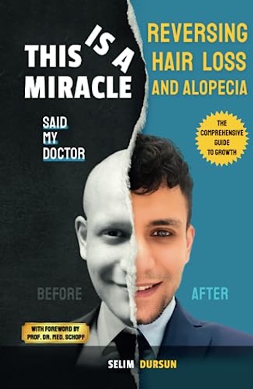 THIS IS A MIRACLE SAID MY DOCTOR: REVERSING HAIR LOSS AND ALOPECIA