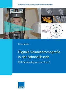Digitale Volumentomografie in der Zahnheilkunde