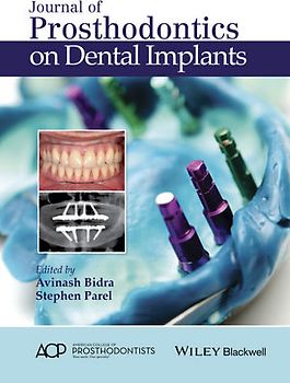 Journal of Prosthodontics on Dental Implants