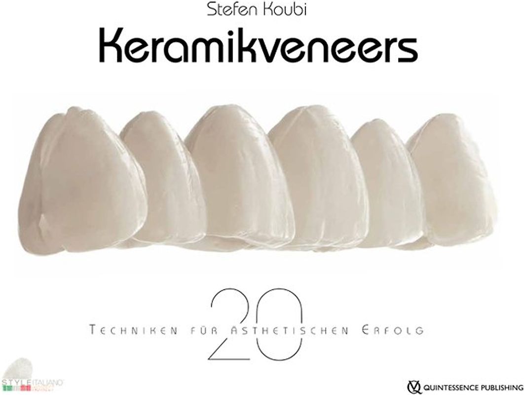 Keramikveneers