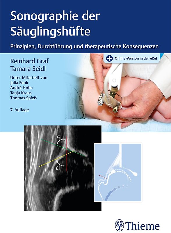 Sonographie der Säuglingshüfte