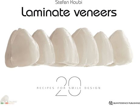 Laminate Veneers