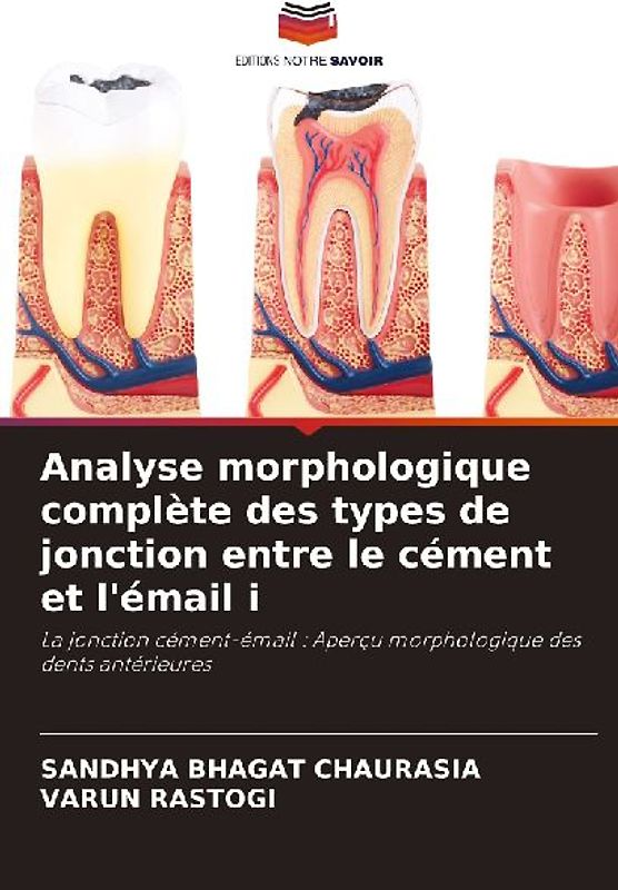 Analyse morphologique complète des types de jonction entre le cément et l'émail i