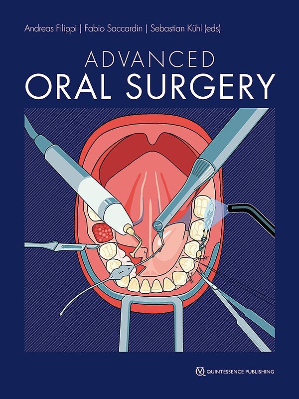 Advanced Oral Surgery