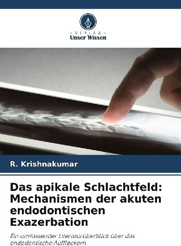 Das apikale Schlachtfeld: Mechanismen der akuten endodontischen Exazerbation