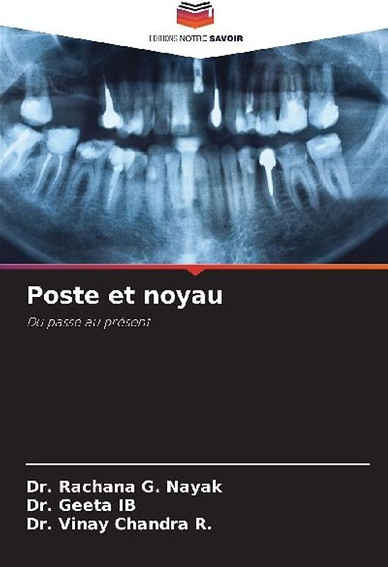 Poste et noyau