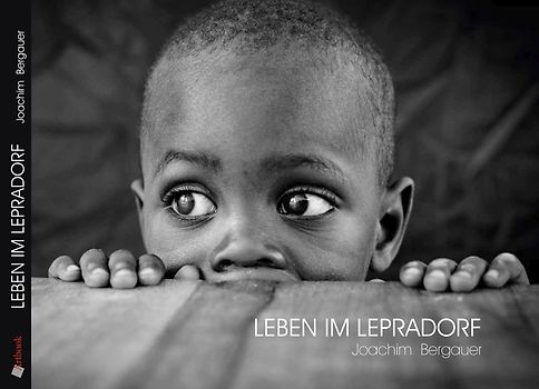 "Leben im Lepradorf"