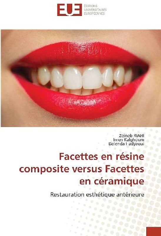 Facettes en résine composite versus Facettes en céramique