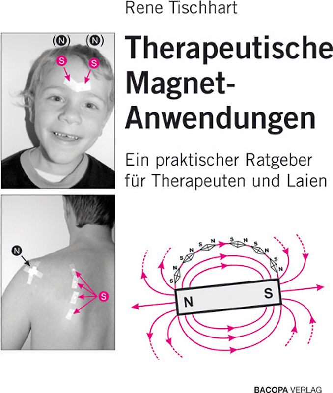 Therapeutische Magnetanwendungen
