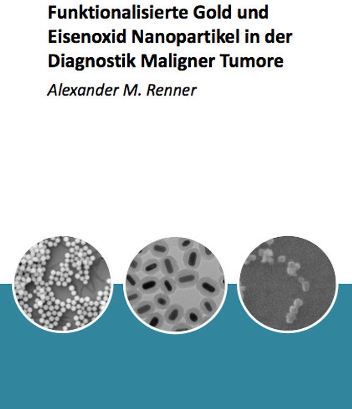 Funktionalisierte Gold und Eisenoxid Nanopartikel in der Diagnostik Maligner Tumore