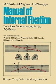 Manual of Internal Fixation