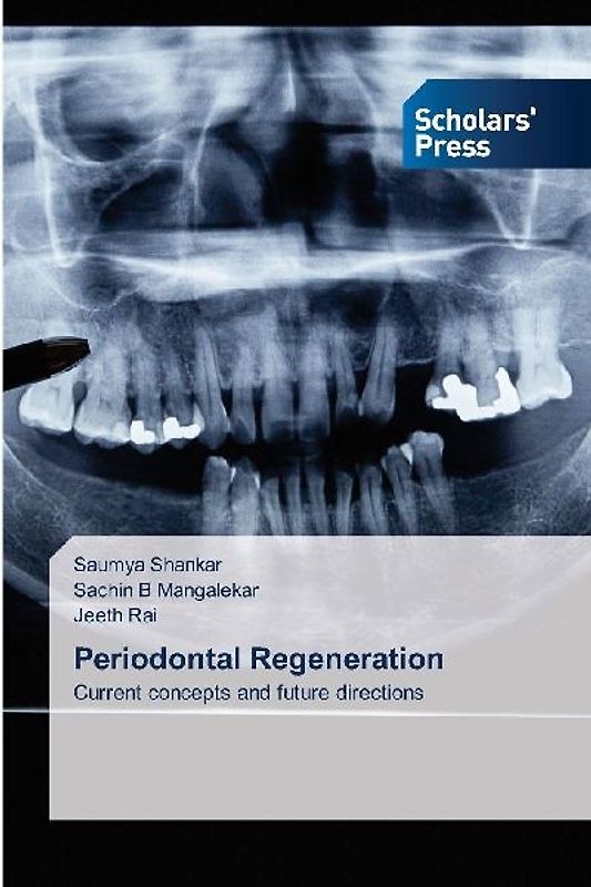 Periodontal Regeneration