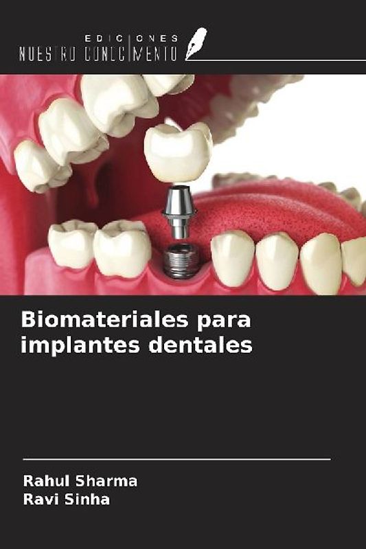 Biomateriales para implantes dentales