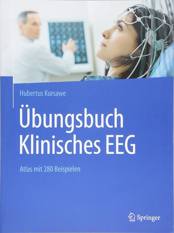 Übungsbuch Klinisches EEG