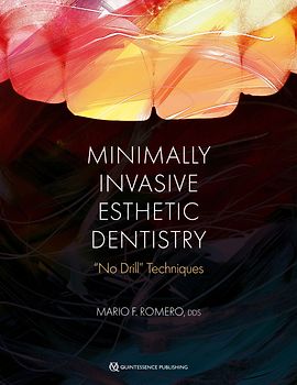 Minimally Invasive Esthetic Dentistry