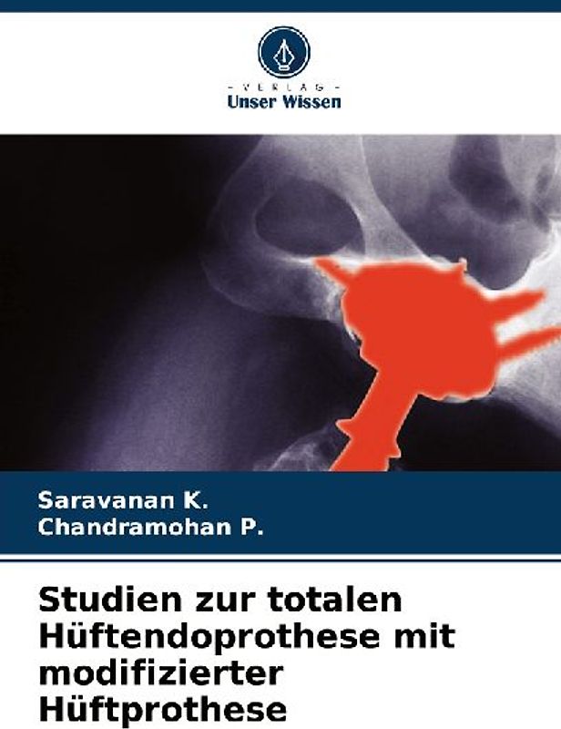 Studien zur totalen Hüftendoprothese mit modifizierter Hüftprothese