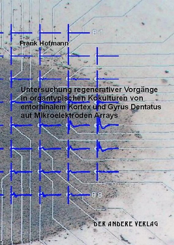 Untersuchungen regenerativer Vorgänge in organtypischen Kokulturen von entorhinalem Kortex und Gyrus Dentatus auf Mikroelektroden Arrays