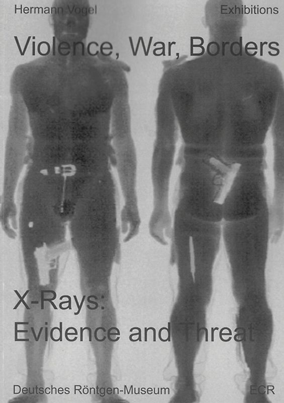 Violence, War, Borders. X-Rays: Evidence and Threat