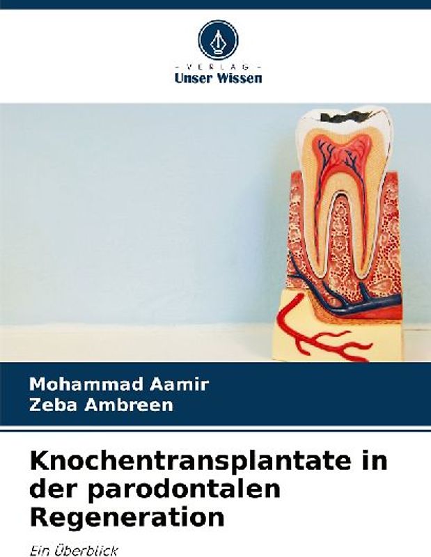 Knochentransplantate in der parodontalen Regeneration