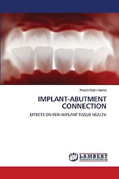 IMPLANT-ABUTMENT CONNECTION