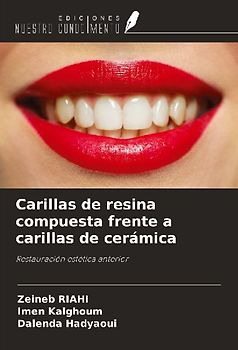 Carillas de resina compuesta frente a carillas de cerámica