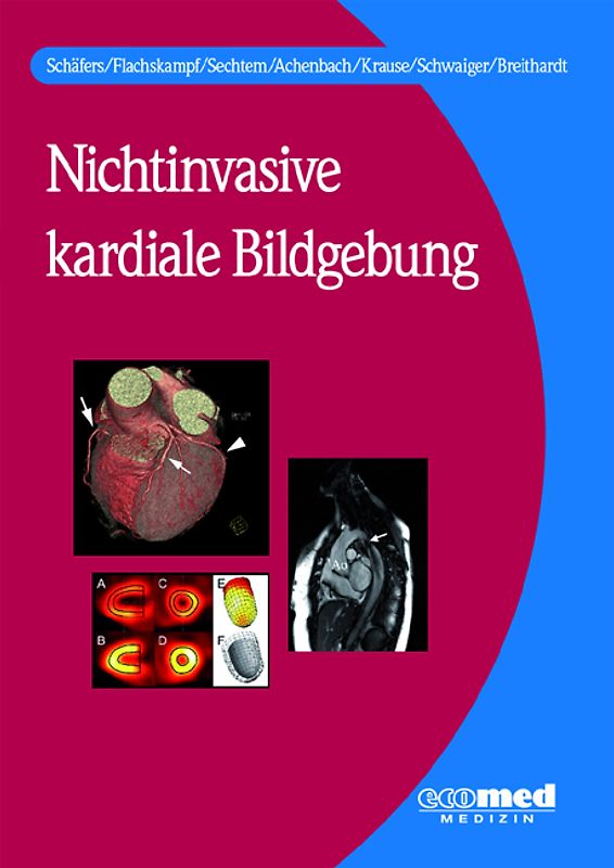 Nichtinvasive kardiale Bildgebung. Spektrum, Methodik, Indikation und Interpretation