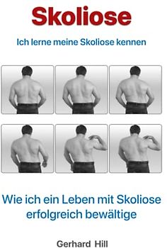 Skoliose: Ich lerne meine Skoliose kennen
