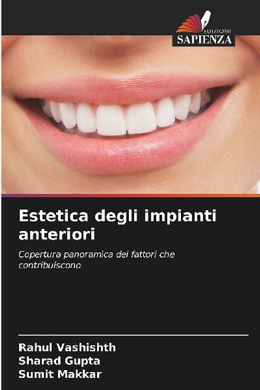 Estetica degli impianti anteriori