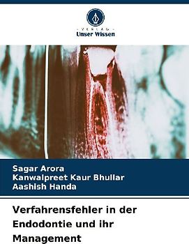 Verfahrensfehler in der Endodontie und ihr Management