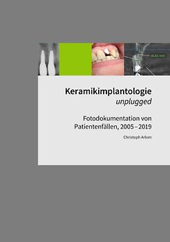 Keramikimplantologie unplugged