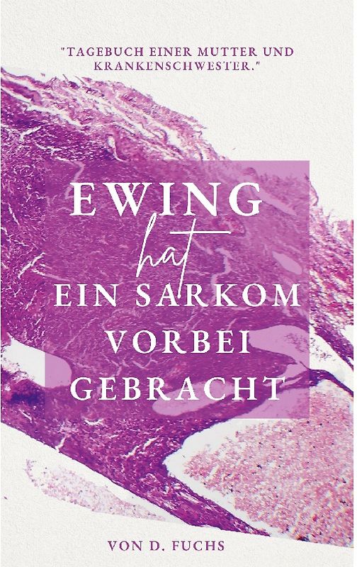 Ewing hat ein Sarkom vorbeigebracht