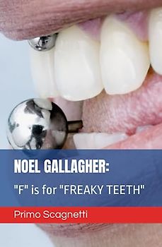 NOEL GALLAGHER: "F" is for "FREAKY TEETH"