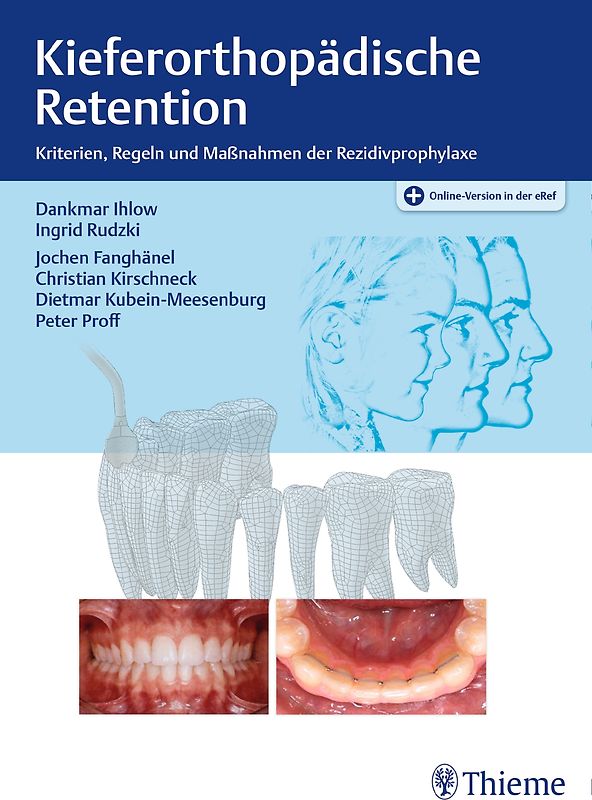 Kieferorthopädische Retention