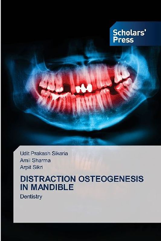 DISTRACTION OSTEOGENESIS IN MANDIBLE