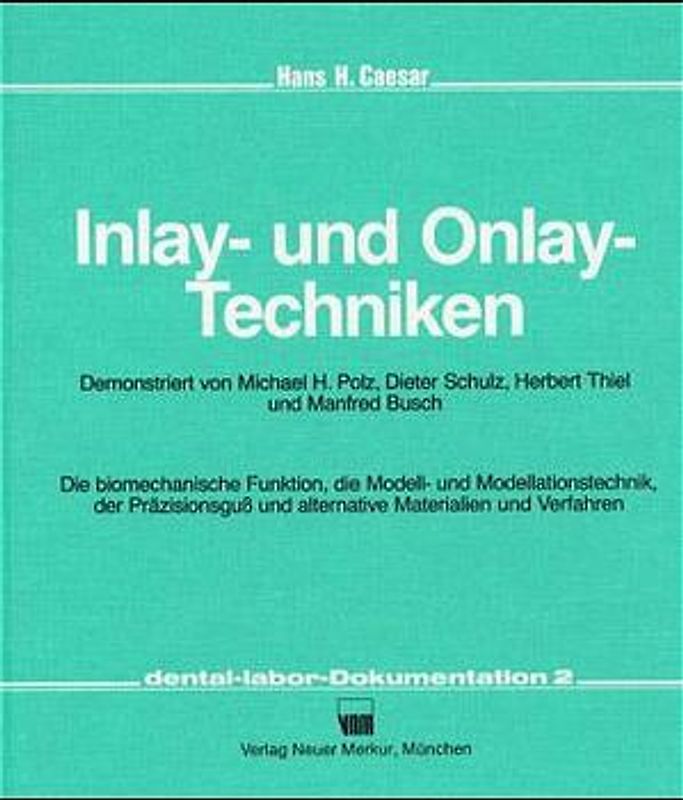 Inlay- und Onlay-Techniken