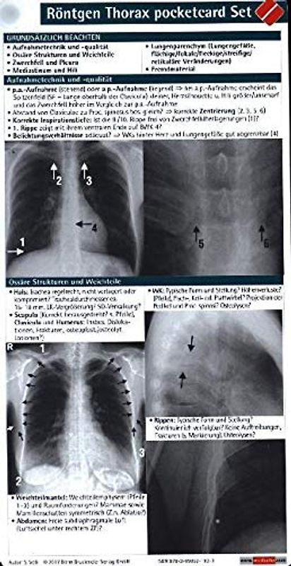 Röntgen Thorax pocketcard Set