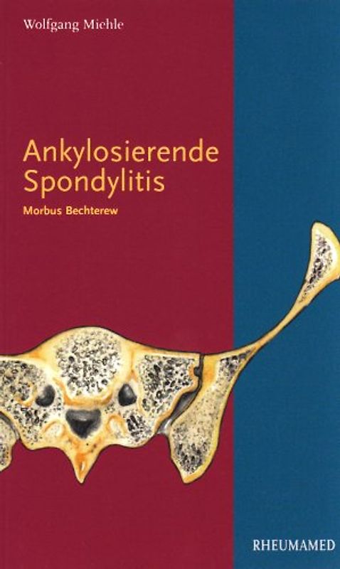 Ankylosierende Spondylitis
