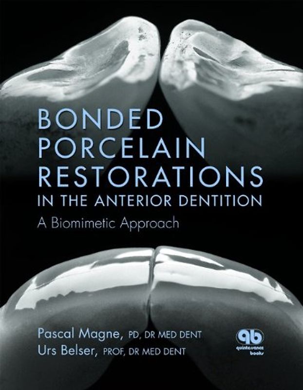 Bonded Porcelain Restorations in the Anterior Dentition: A Biomimetic Approach -  Pascal Magne [Hardcover]
