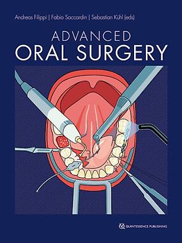 Advanced Oral Surgery