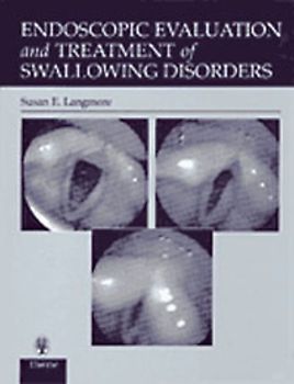 Endoscopic Evaluation and Treatment of Swallowing Disorders