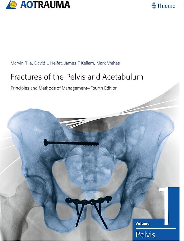 Fractures of the Pelvis and Acetabulum (AO)