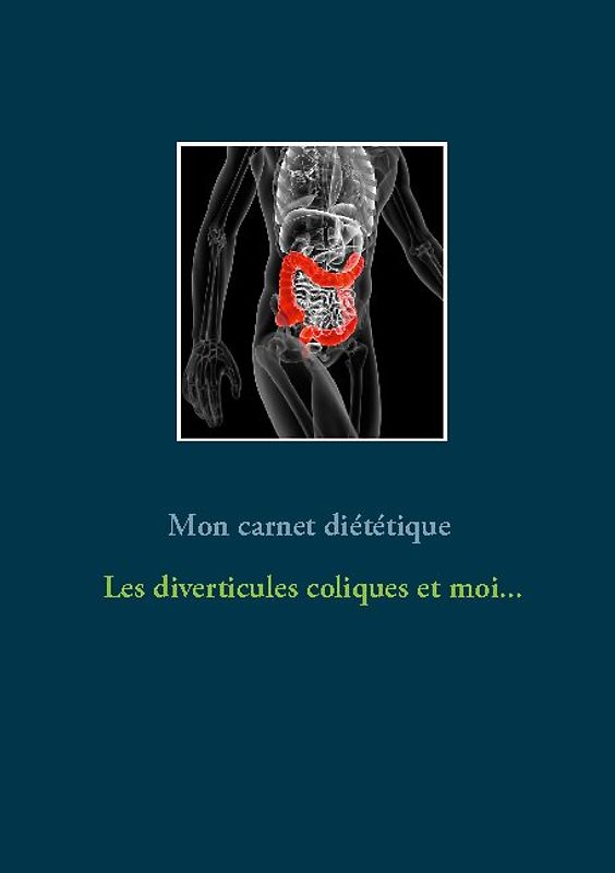 Mon carnet diététique : les diverticules coliques et moi...